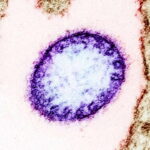 NIPAH VIRUS