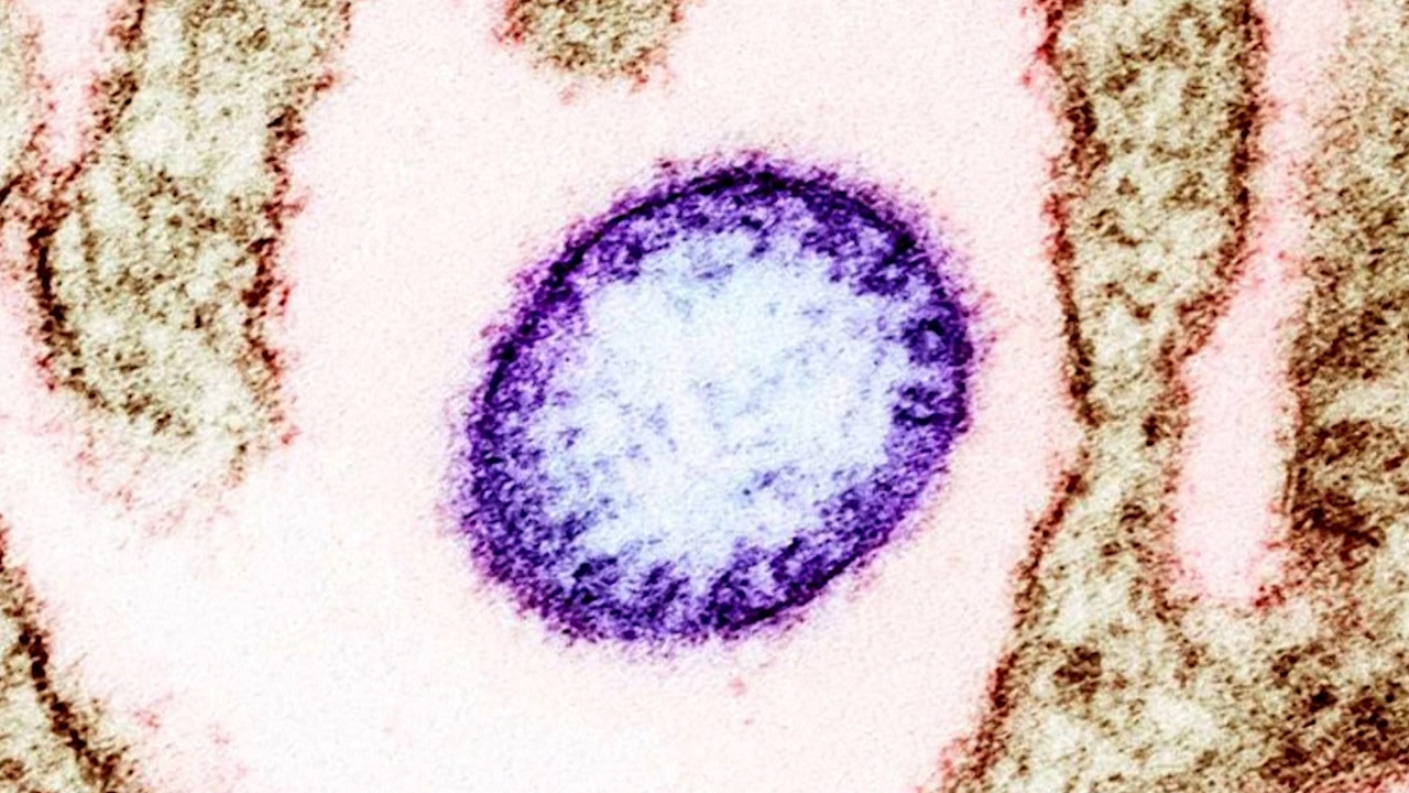 NIPAH VIRUS